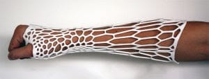 3d-printed-arm-cast